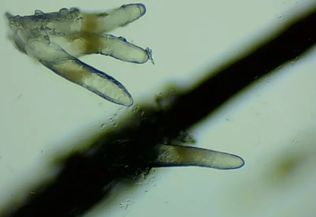 螨蟲(chóng)檢查